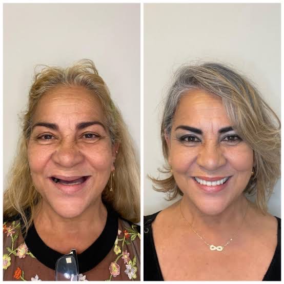 Dentista e implante Brunetto Slovinscki